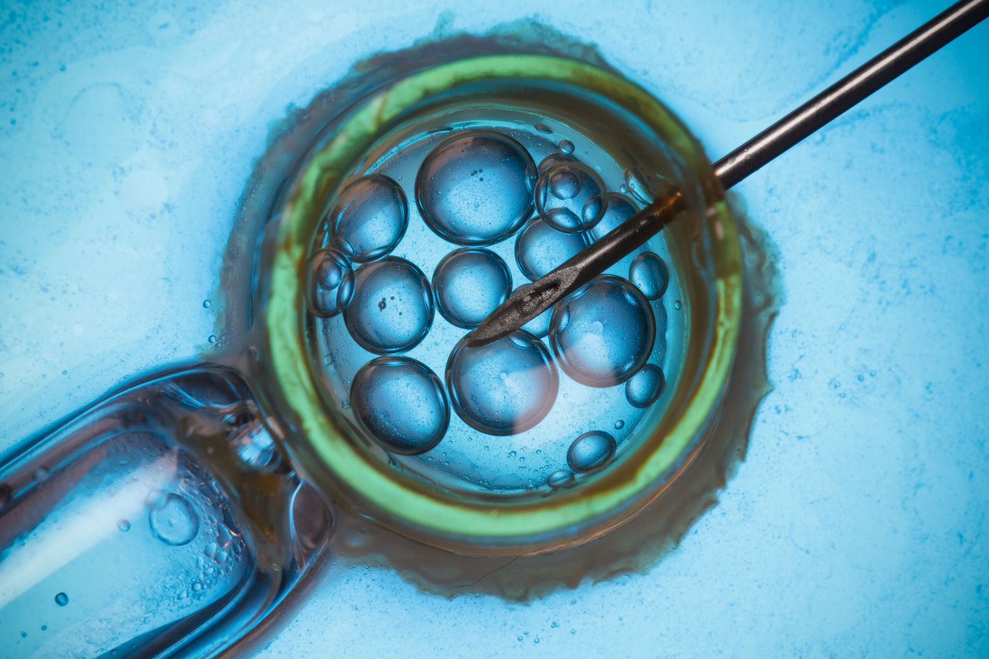 Cairo Consensus Guidelines on IVF Culture Conditions