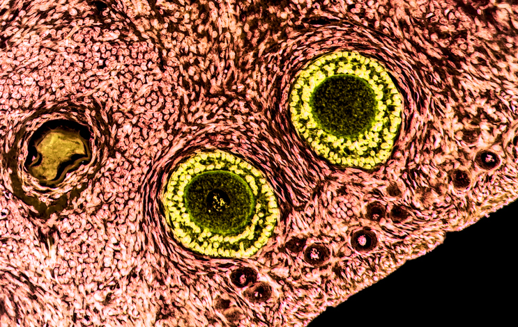 Ovarian tissue